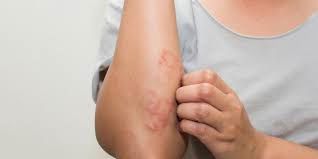 Antonio Carlos Biel-8