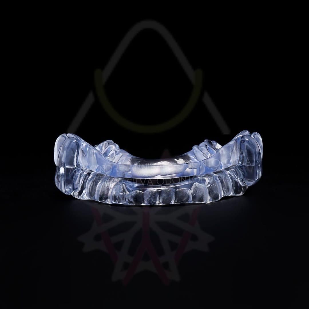 Alexandre Annibale-1