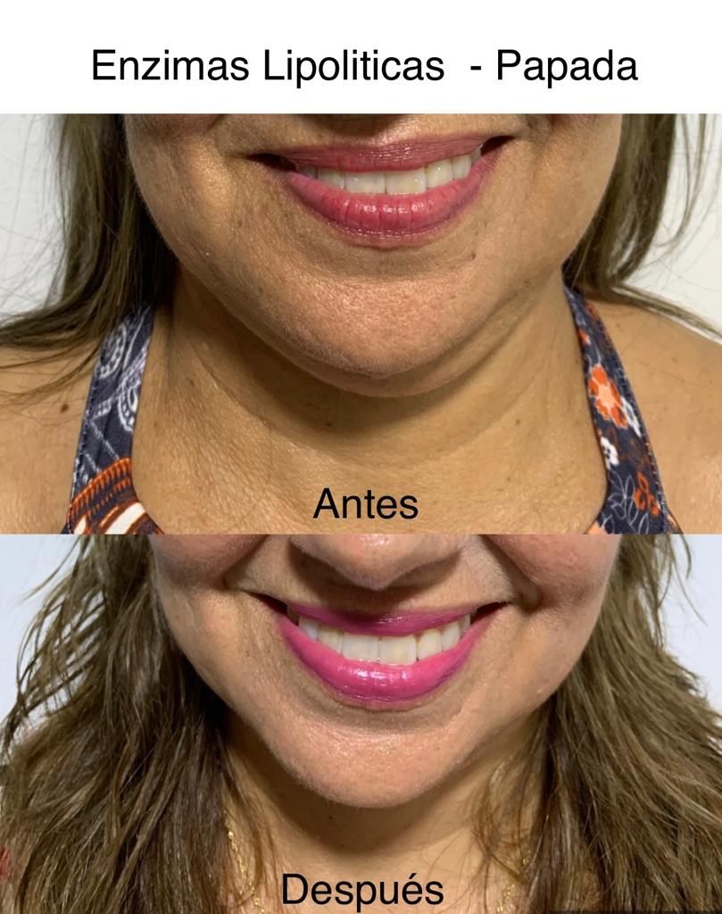 Maria Gisela Angel Losada-80