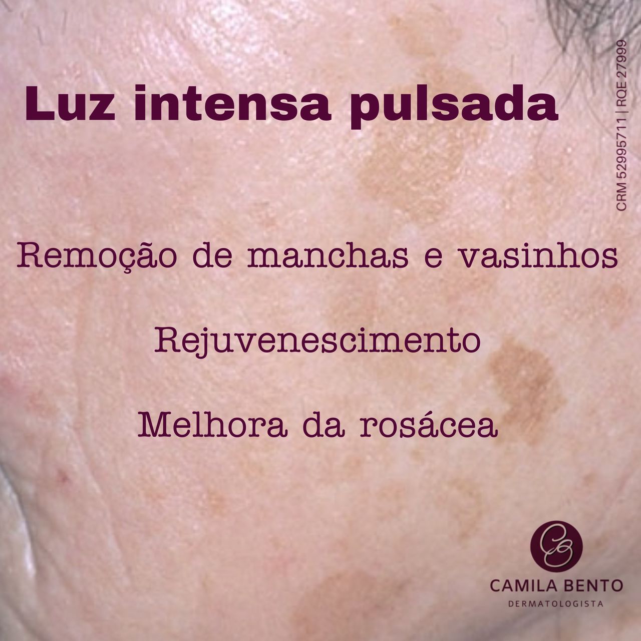 Camila De Oliveira Bento-3