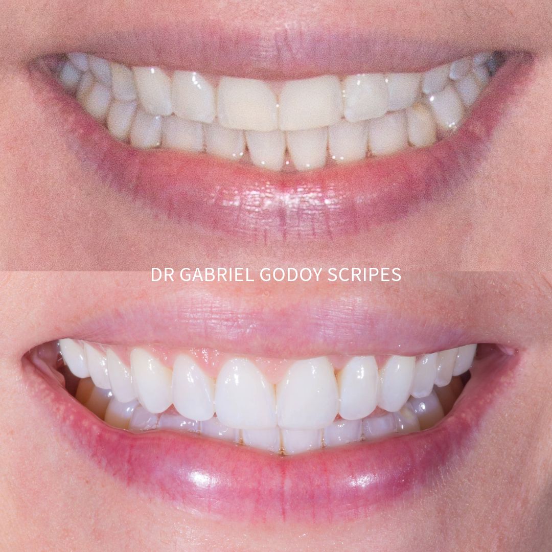 Gabriel Godoy Scripes-3