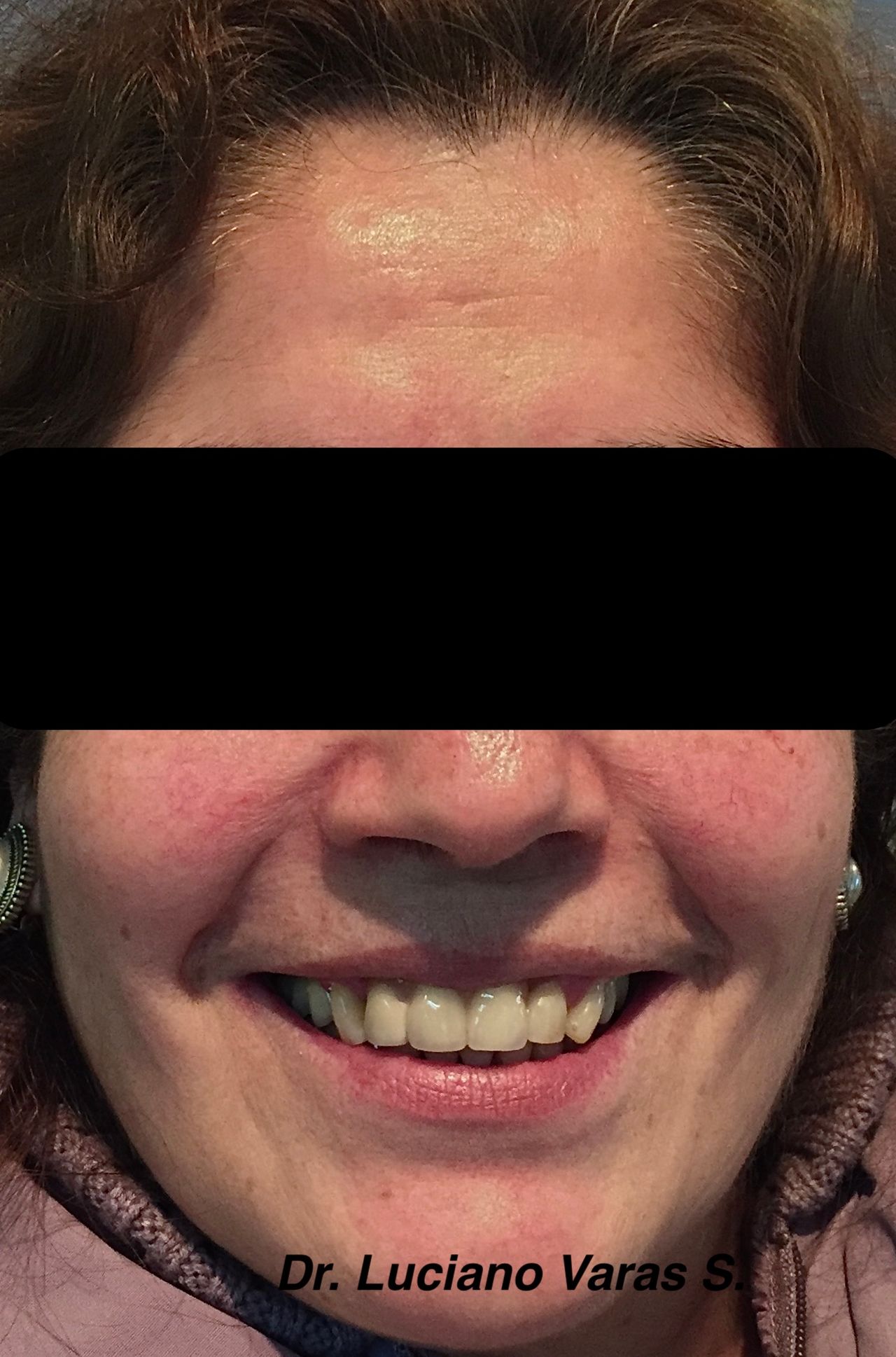 Luciano Varas Salinas-9