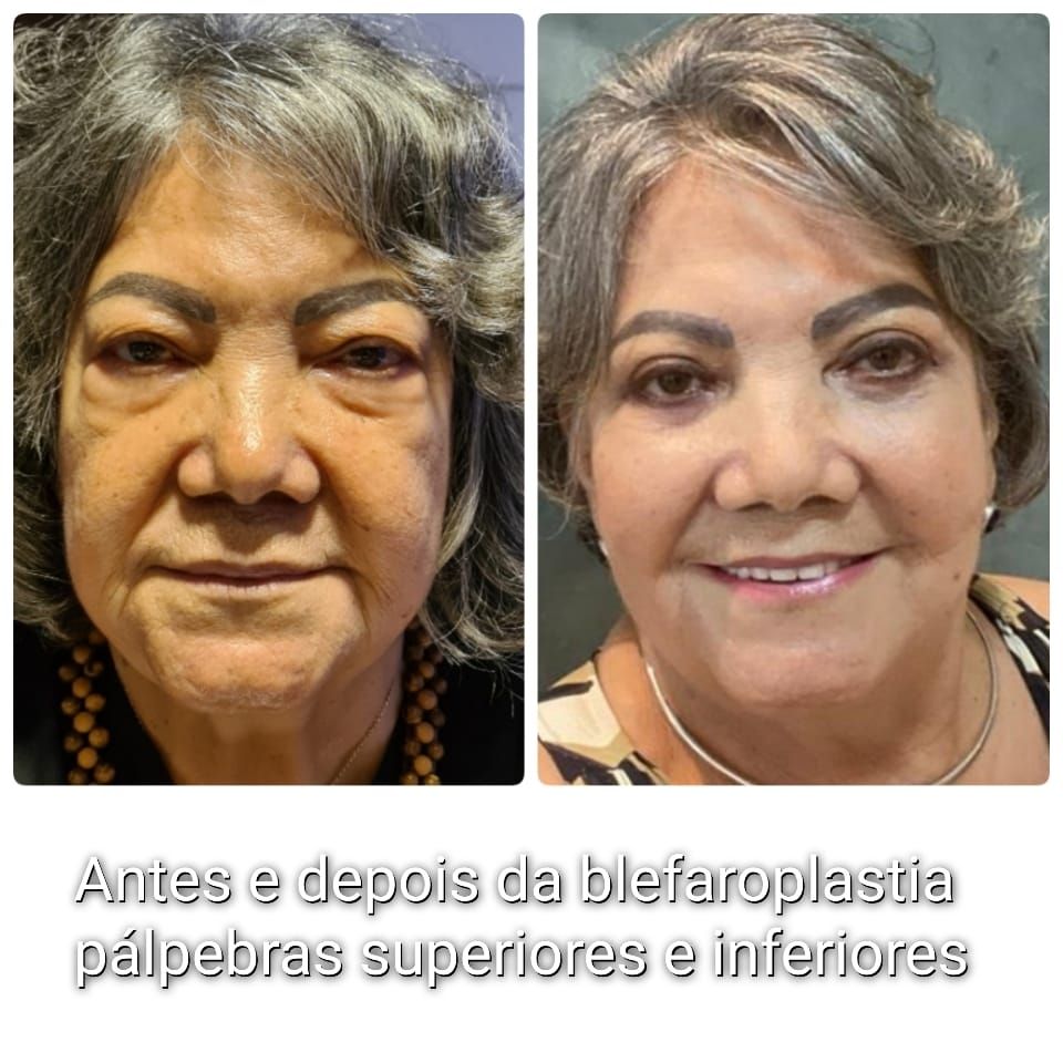 Ingrid  Lustosa Madeira Neves-23