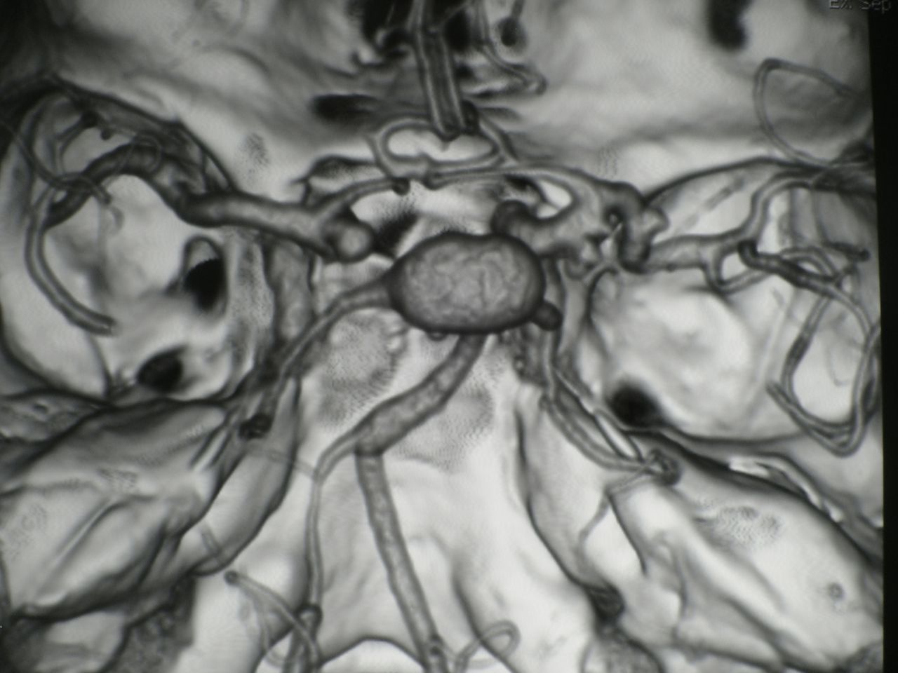 Leonardo Conrado Silva Lima-3