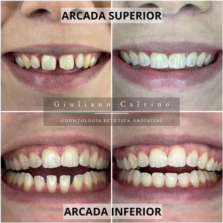 Giuliano  Calvino-10