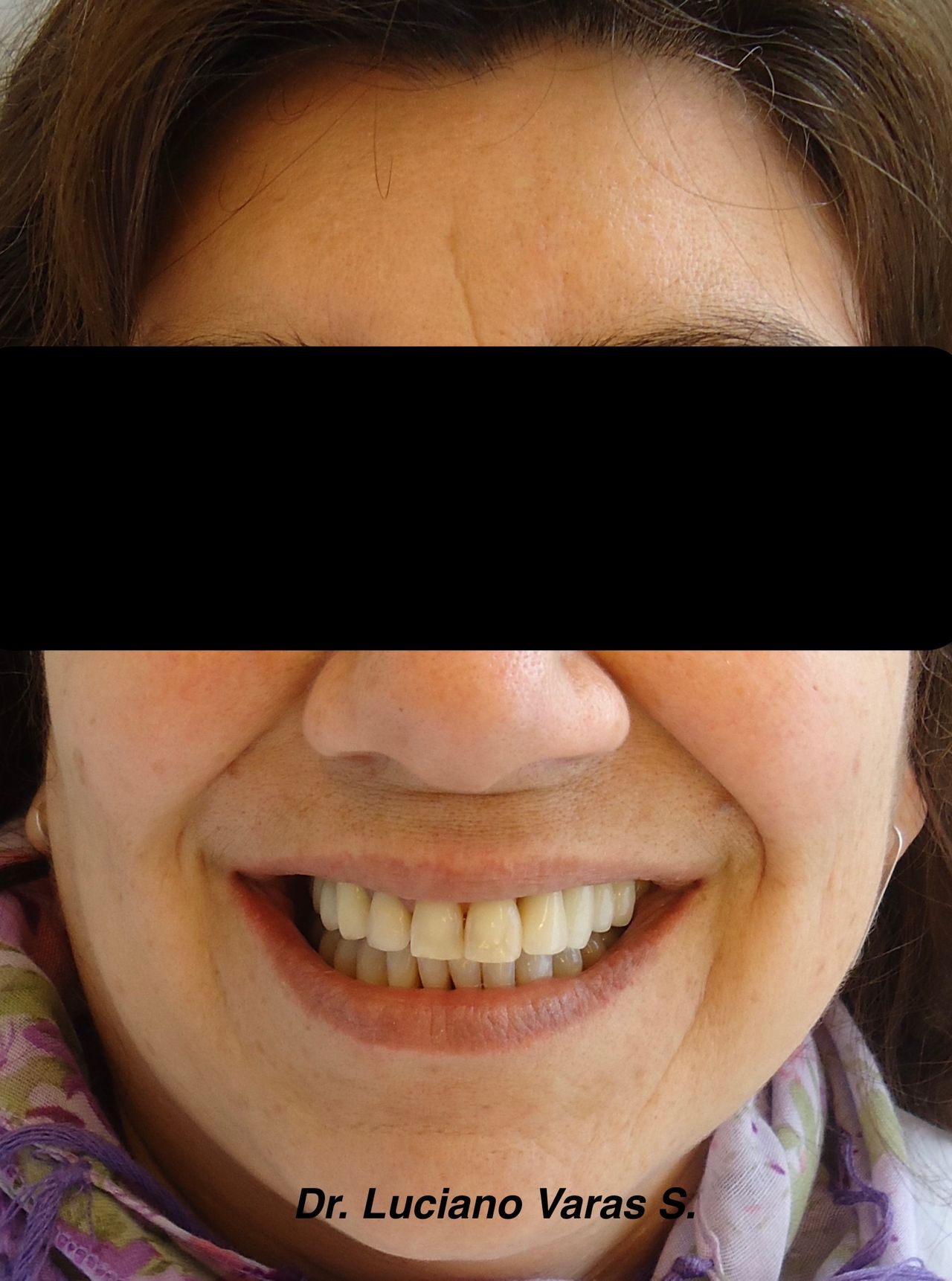 Luciano Varas Salinas-7