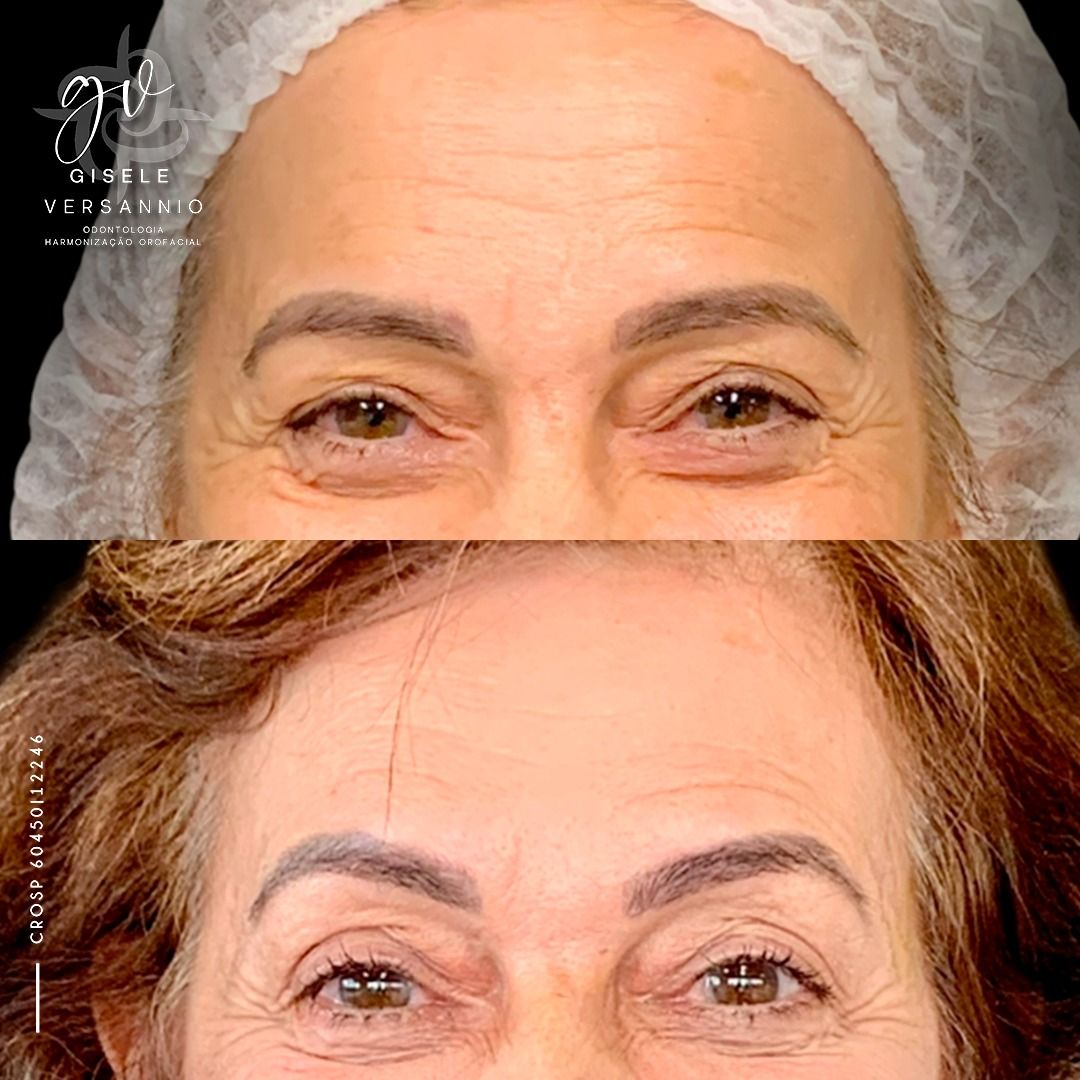 Gisele De Carvalho Versannio-27