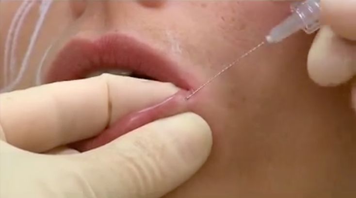 Diego Chiara Chaves-8