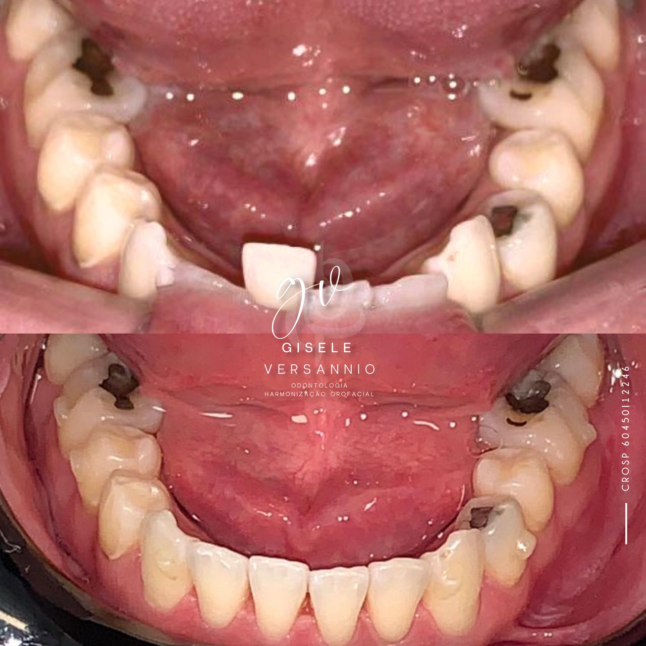 Gisele De Carvalho Versannio-9