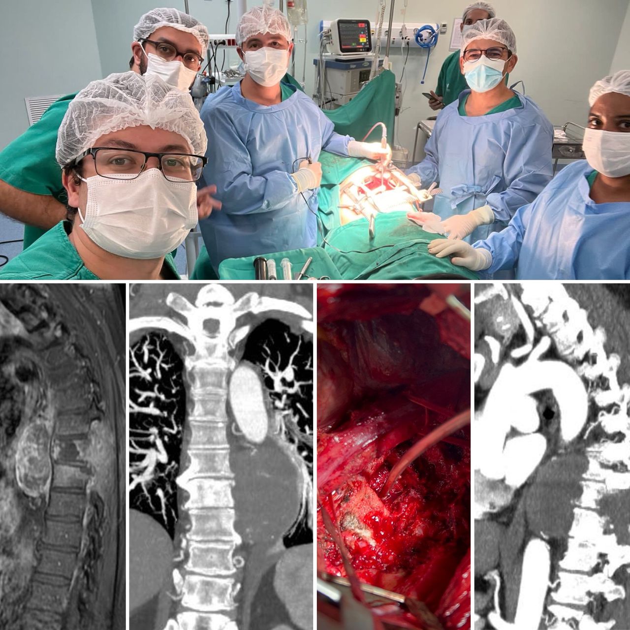 José Lopes Sousa Filho-9