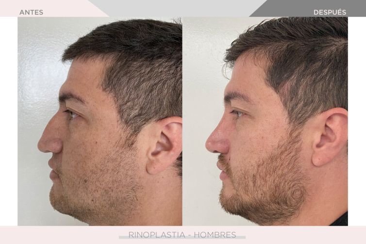 Denise Ventura Perez-13