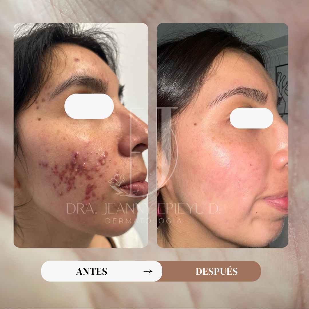 Jeanny Epieyu Diaz-14