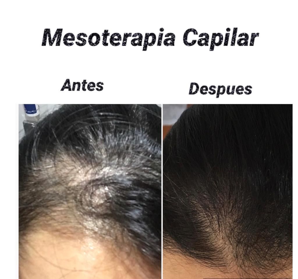 Maria Gisela Angel Losada-86