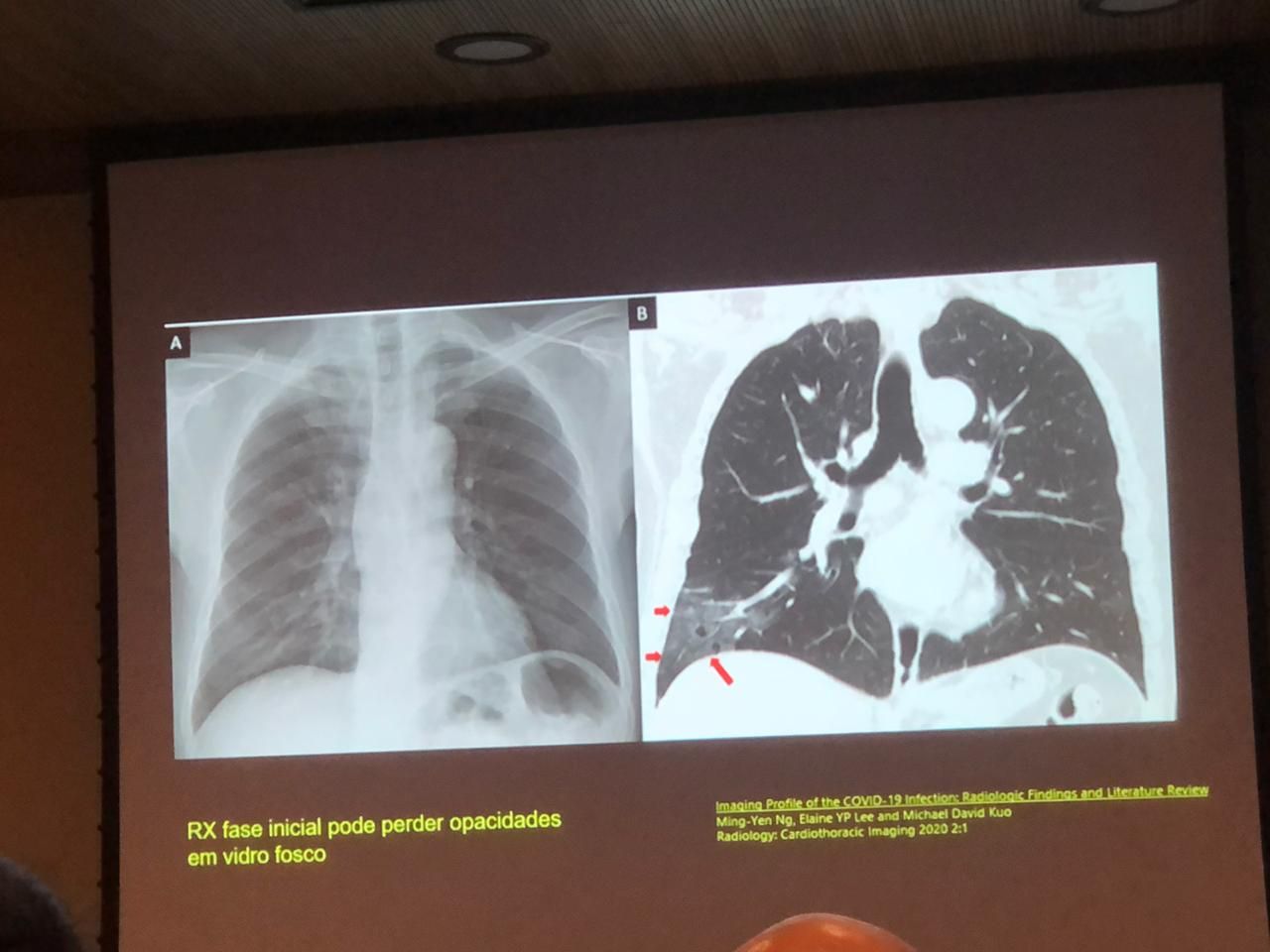 Larissa Cau Carlet-15