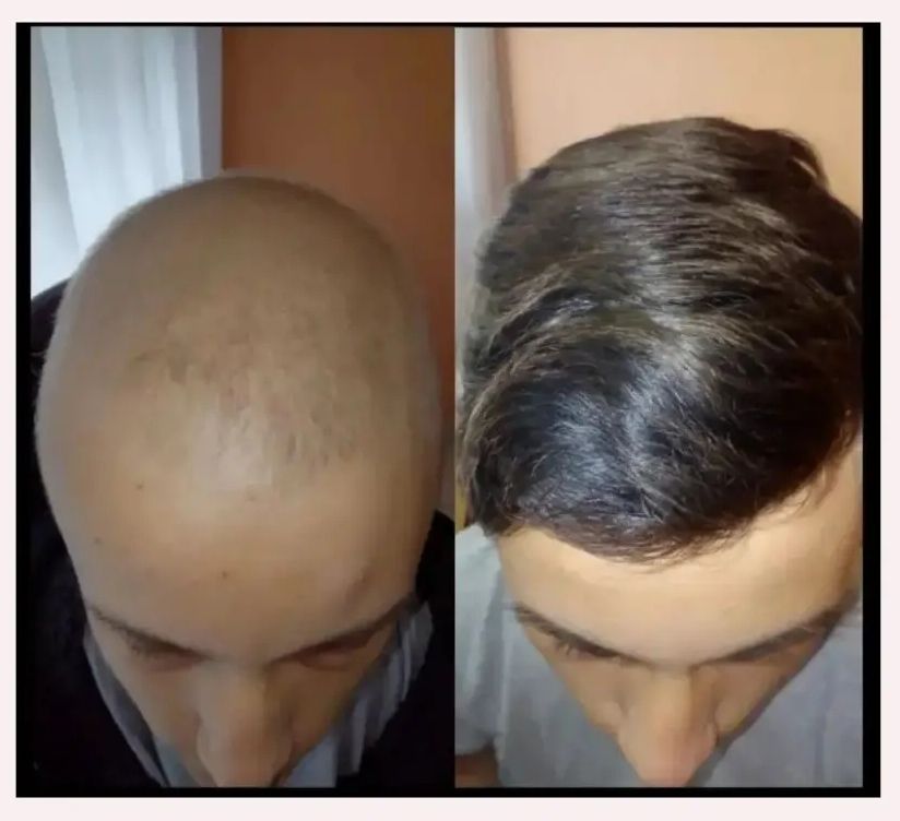 Fernando Vasquez Maldonado-7