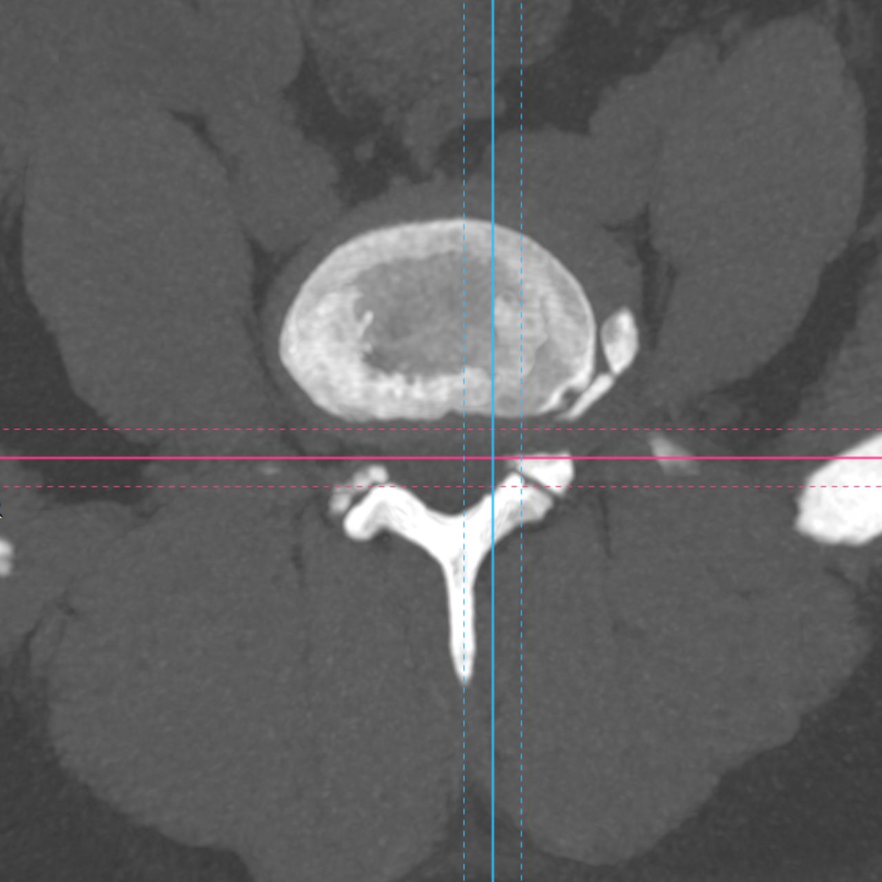 David Tafur Muñoz-2392