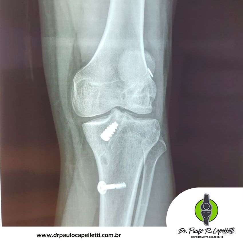 Paulo Roberto Capelletti-3