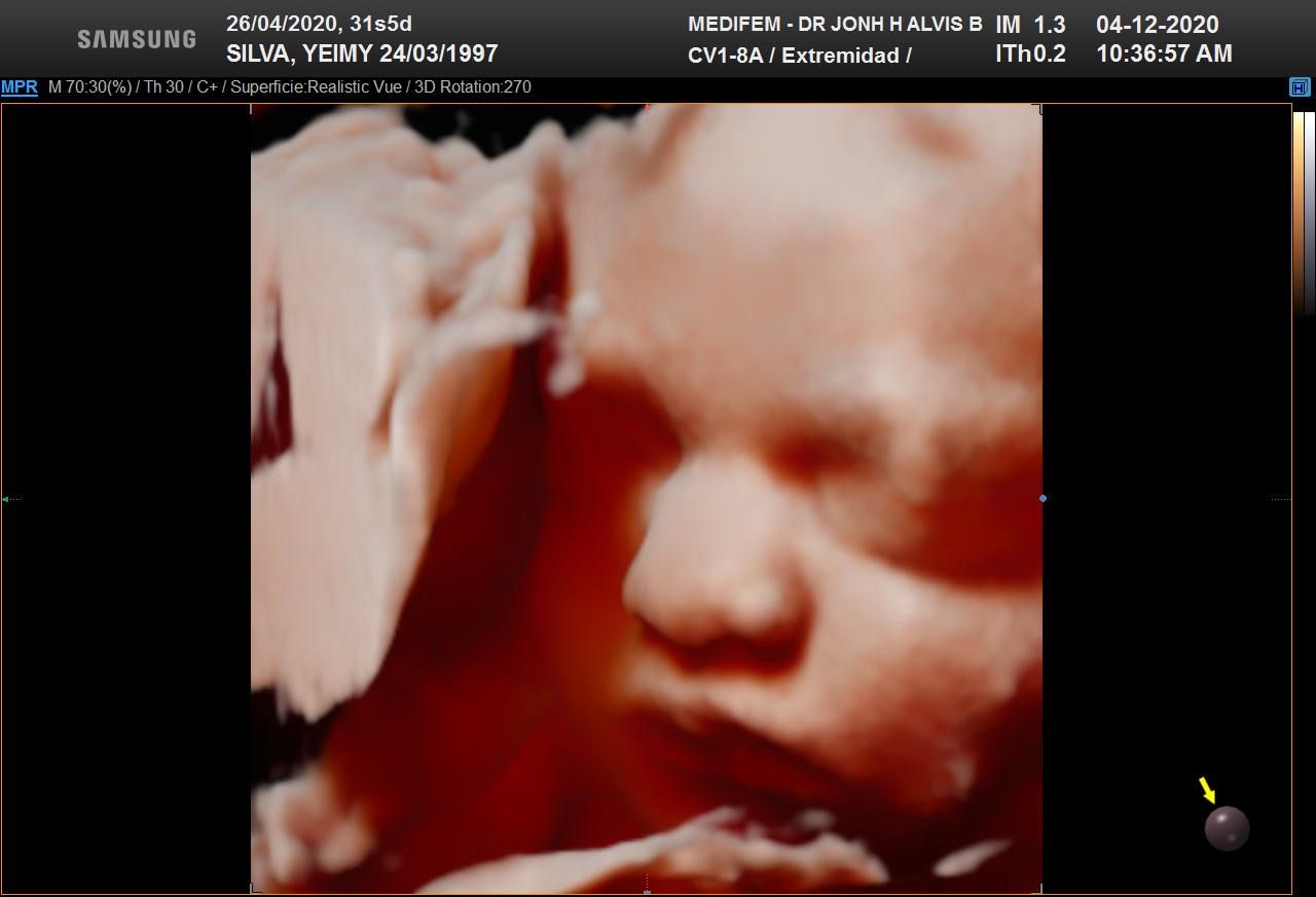 Jonh Harold Alvis Botello-9