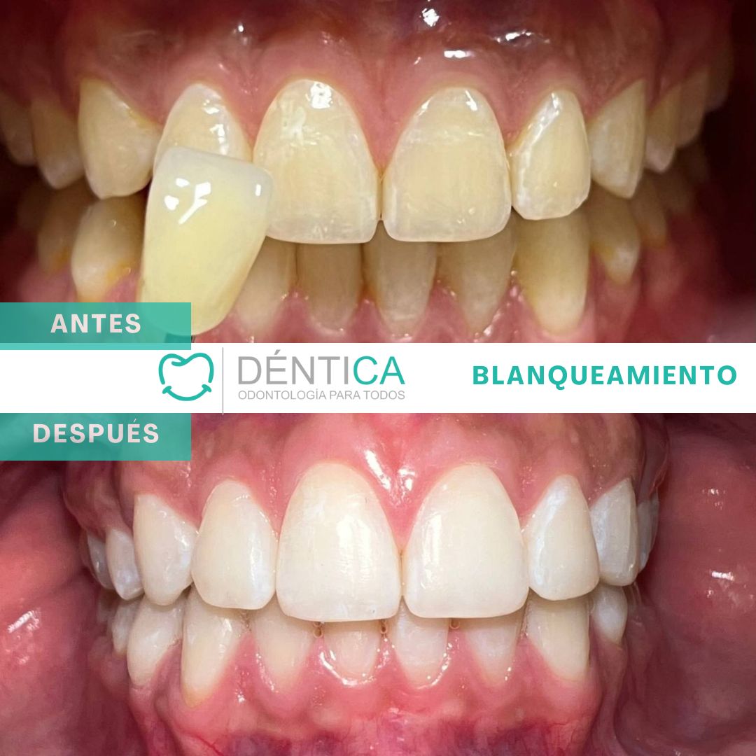 Estefani Canches Caballero-11