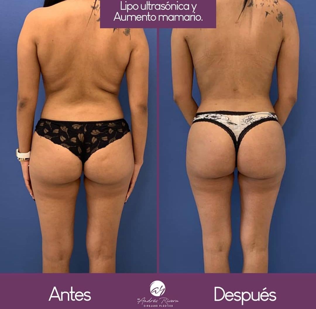 Andrés Rivera López-3