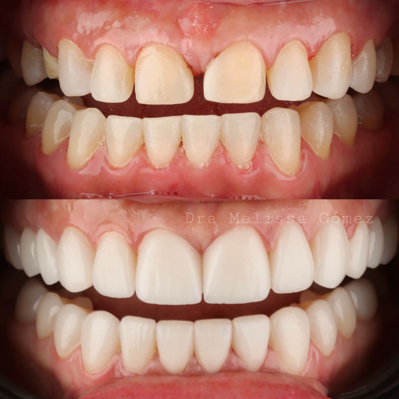 Melissa Gómez Arango-10