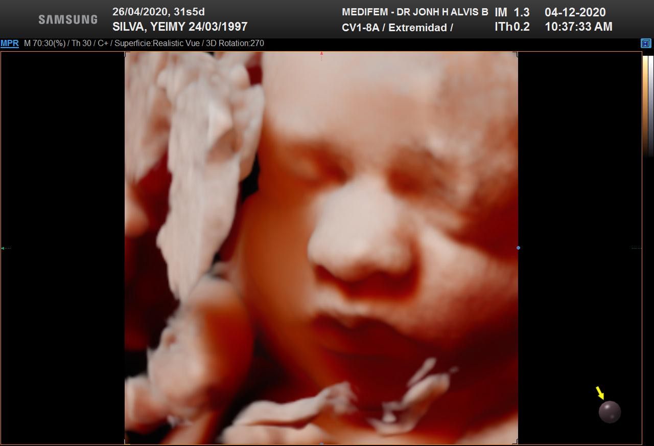 Jonh Harold Alvis Botello-10