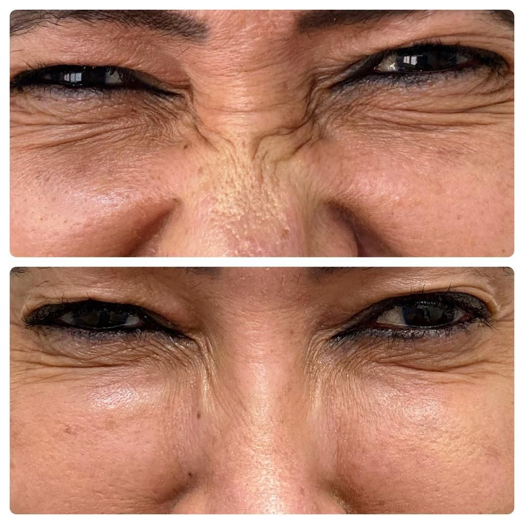 Luiz Antonio Da Silva-12