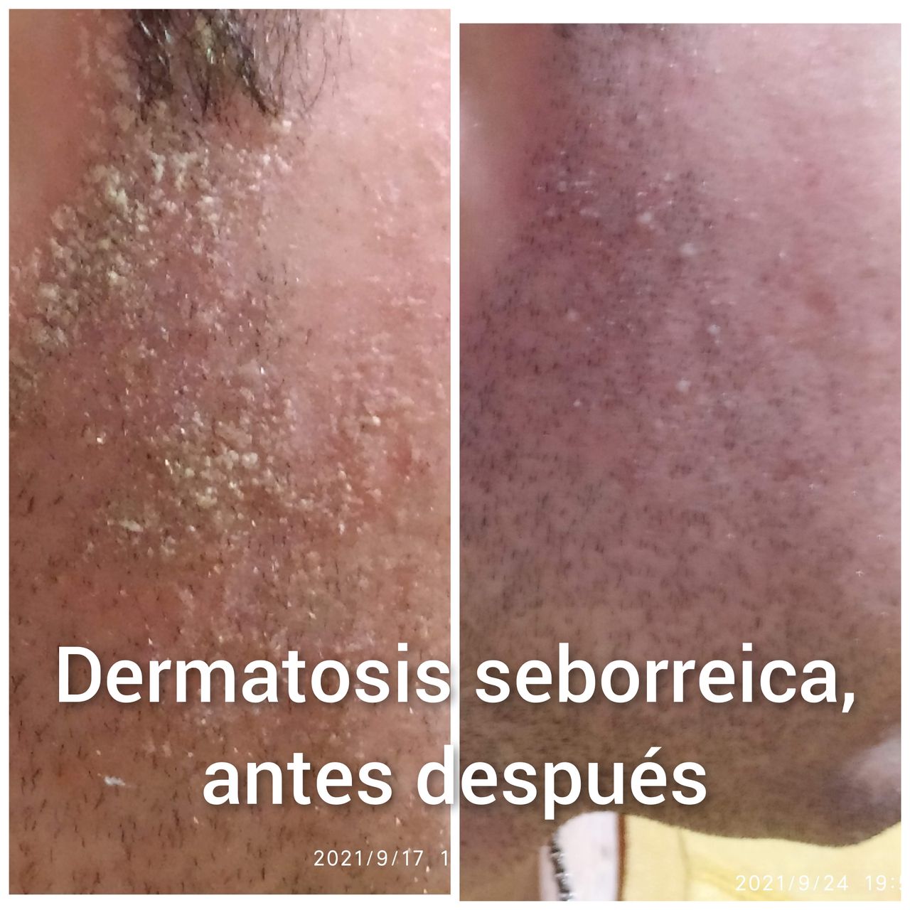 Alejandra Meijide-21