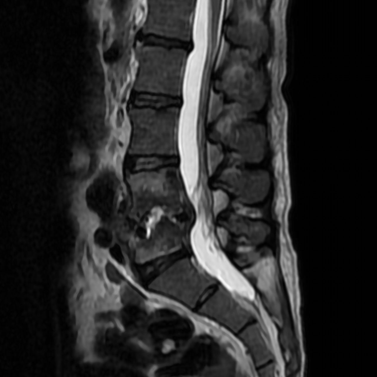 David Tafur Muñoz-1836