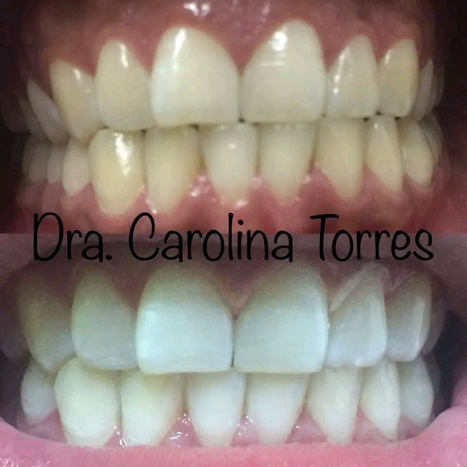 Carolina Alejandra Torres Acuña-2