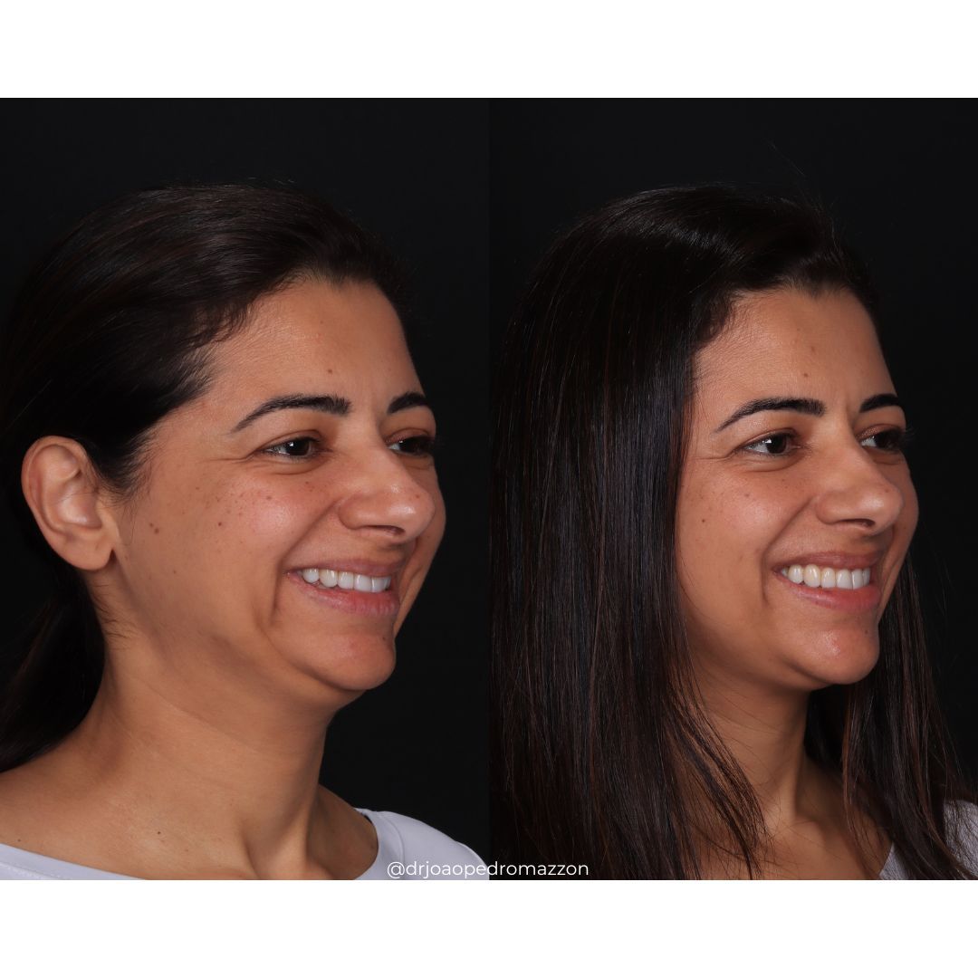 João Pedro Paulino Mazzon-6