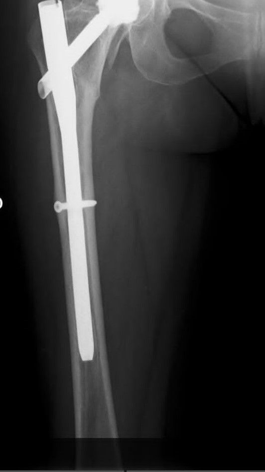 Luz Angela Murcia Camargo-12