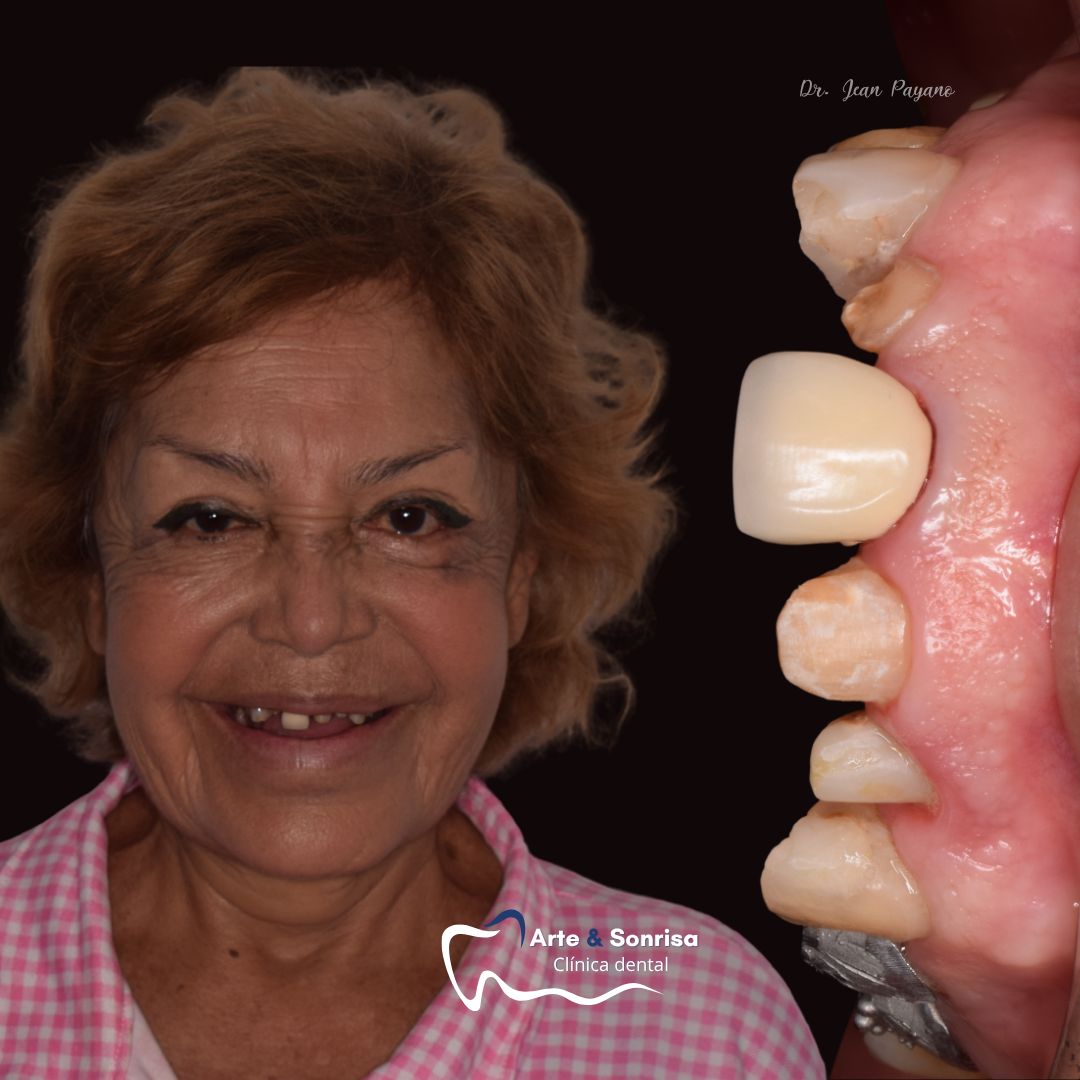 Jean Carlos Payano Arcos-3