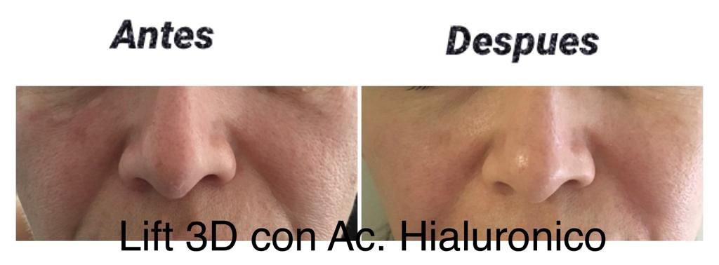 Maria Gisela Angel Losada-64