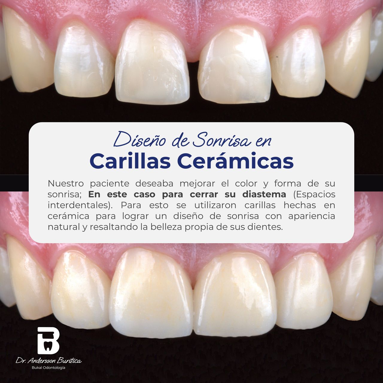 Andersson Buritica-3