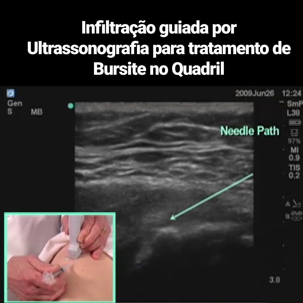 Victor Fontes Pacheco-46