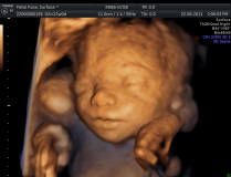 Diego Giovanni Rubiano Zarate-8