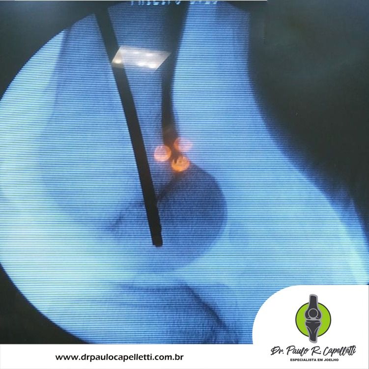 Paulo Roberto Capelletti-79