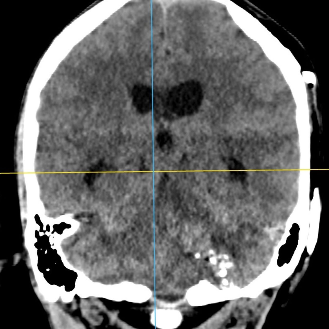 David Tafur Muñoz-1416