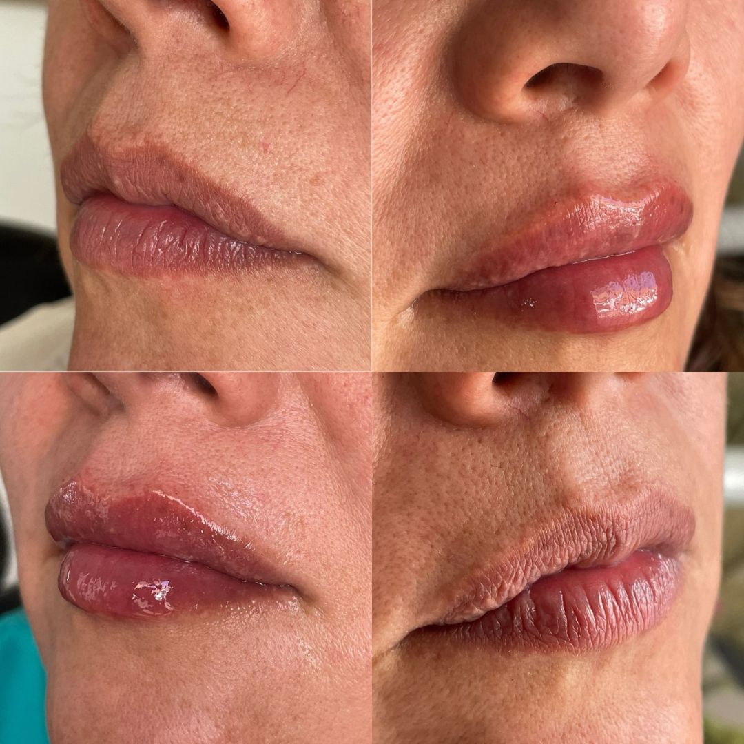 Scarlett Bartsch Ferrada-32