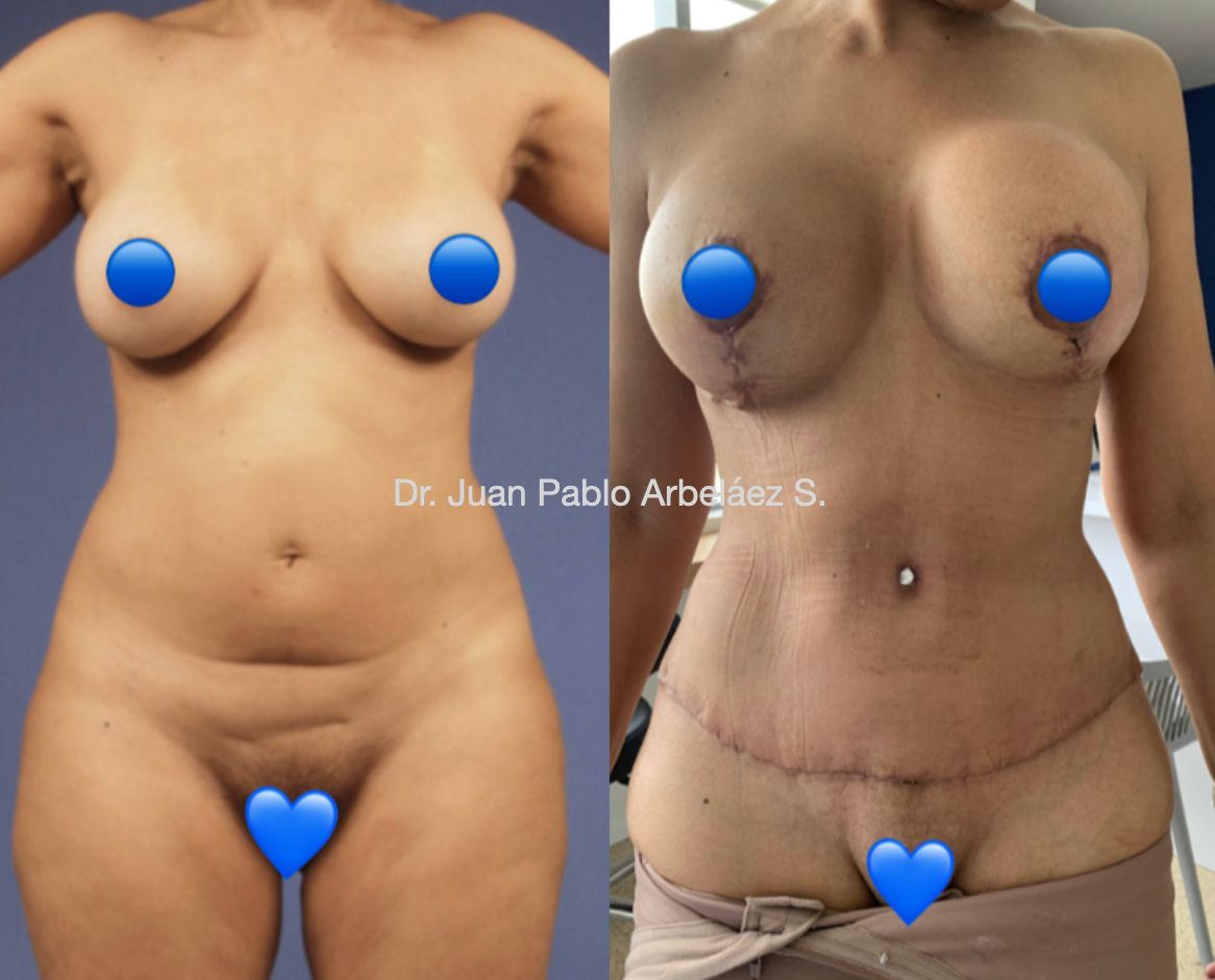 Juan Pablo Arbeláez Sierra-38