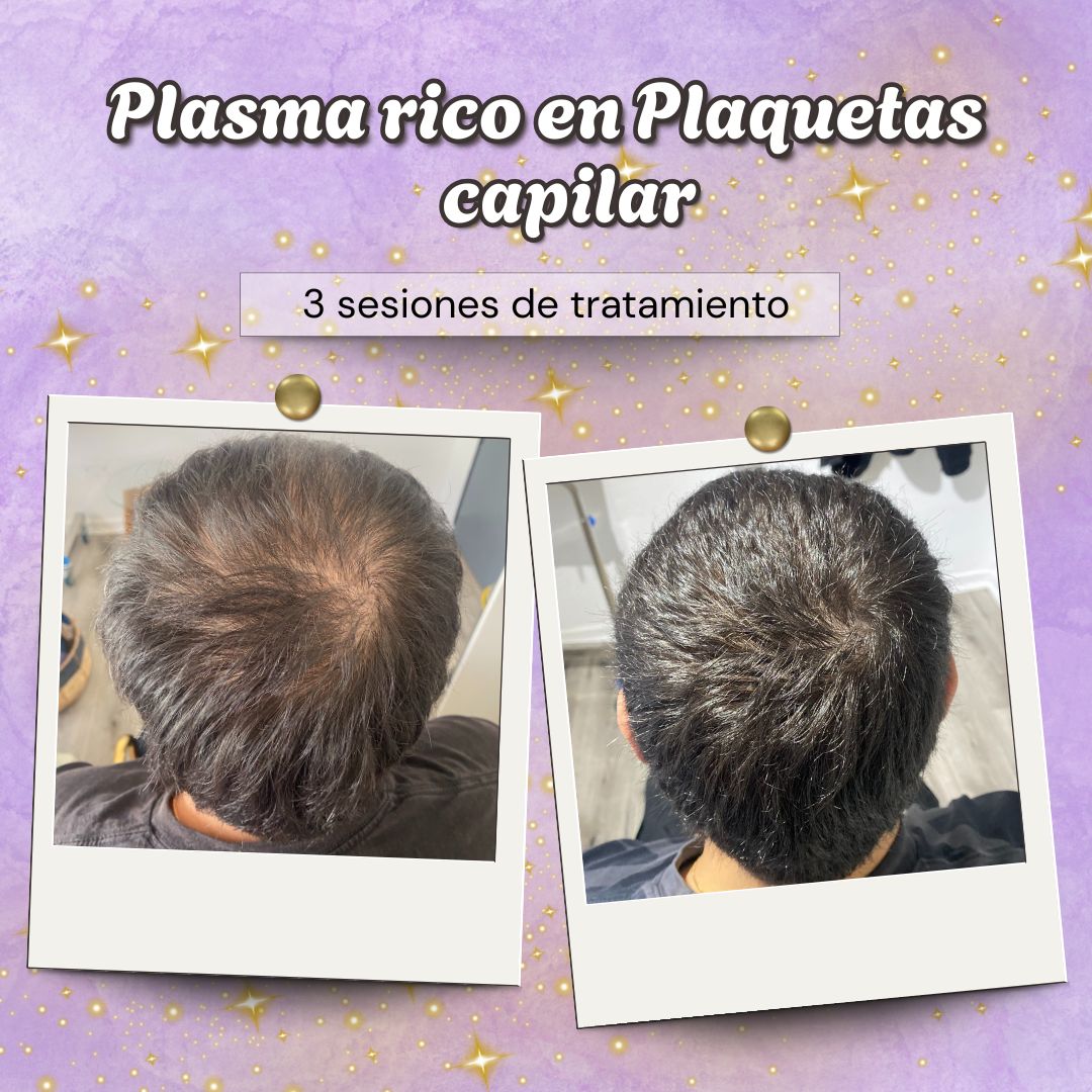 Scarlett Bartsch Ferrada-39