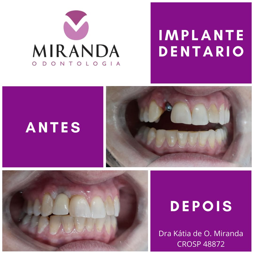 Kátia De Oliveira Miranda-14