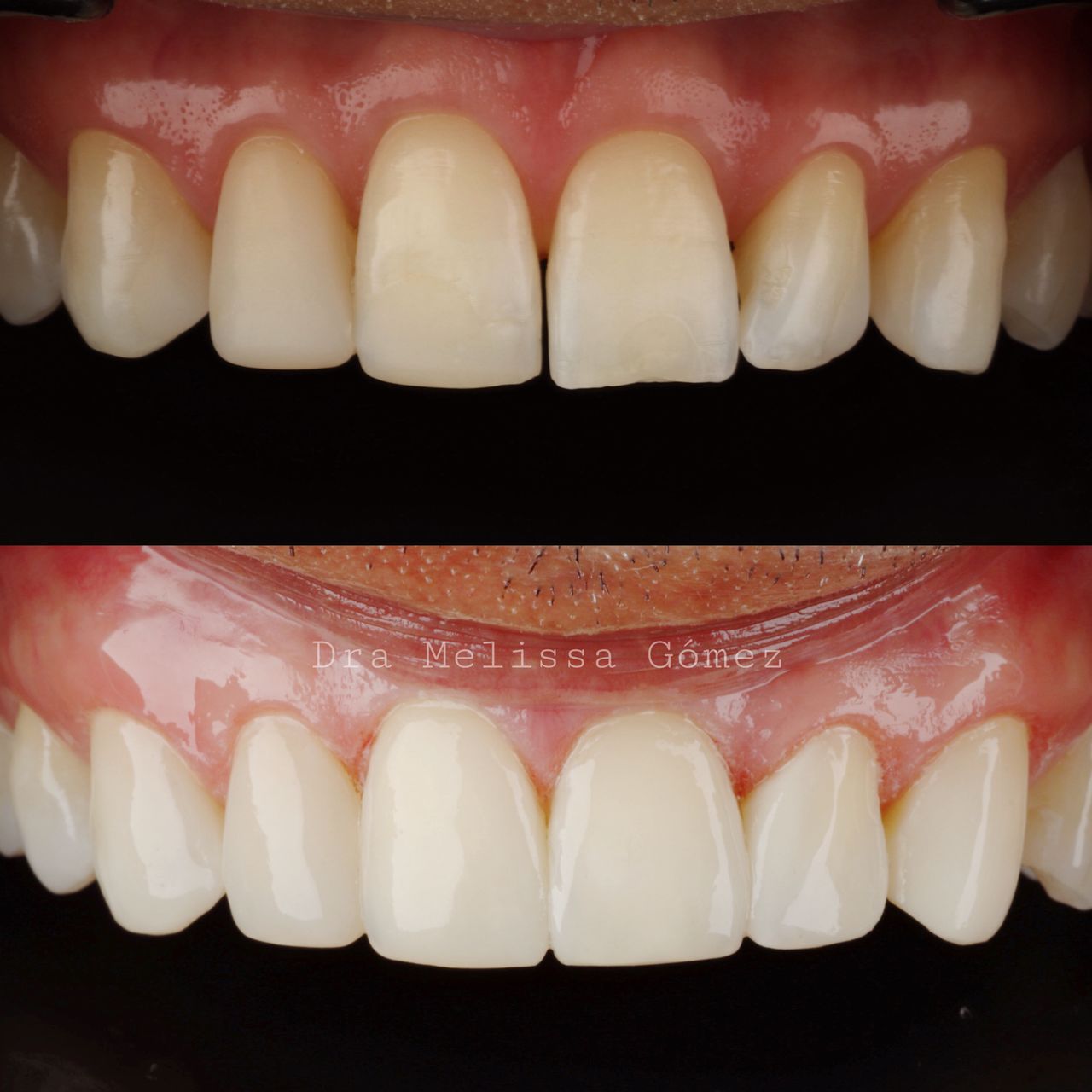 Melissa Gómez Arango-6