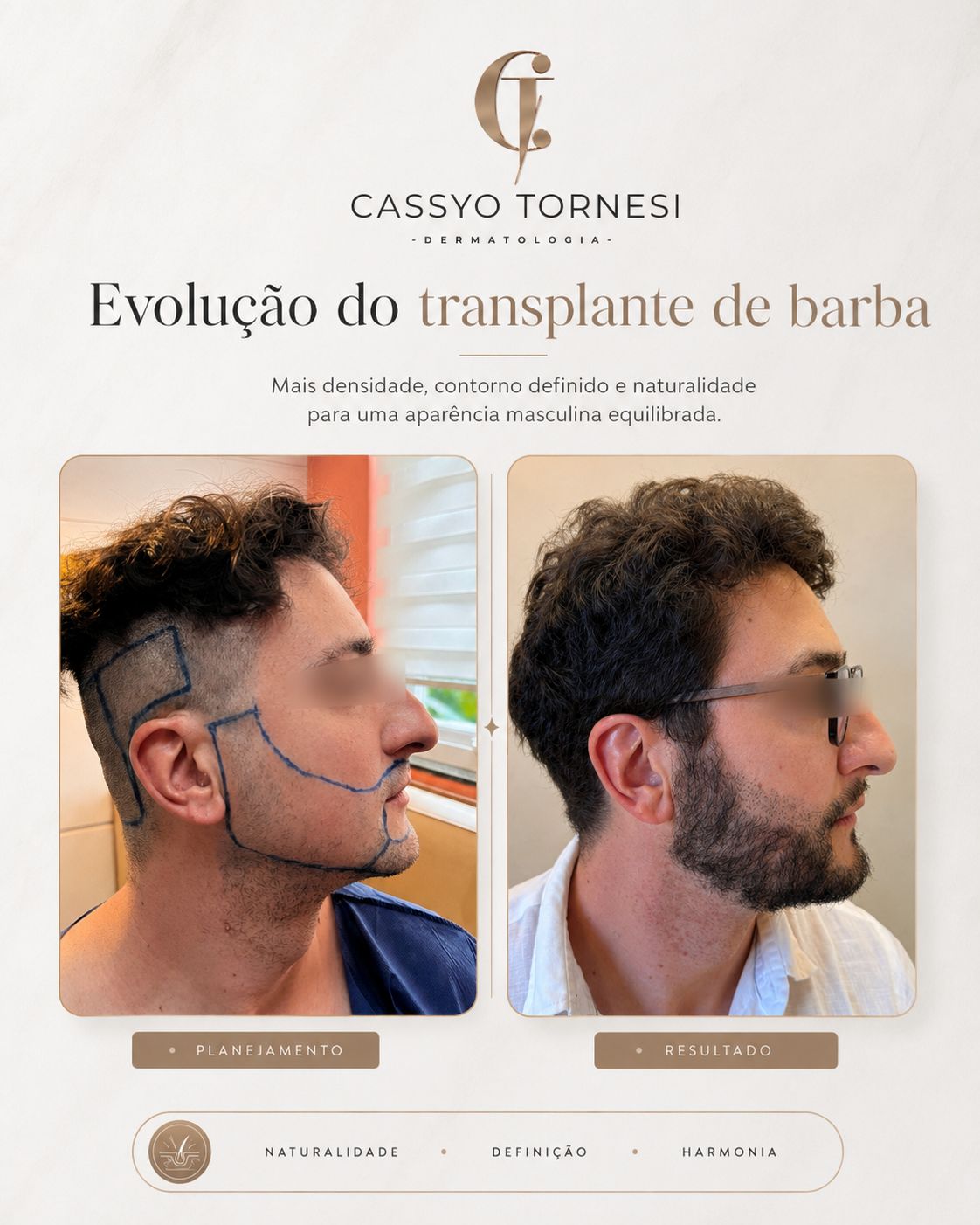 Cassyo Tornesi-12