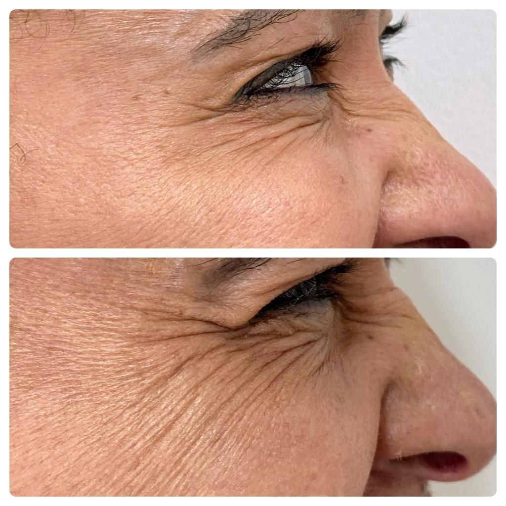 Luiz Antonio Da Silva-8