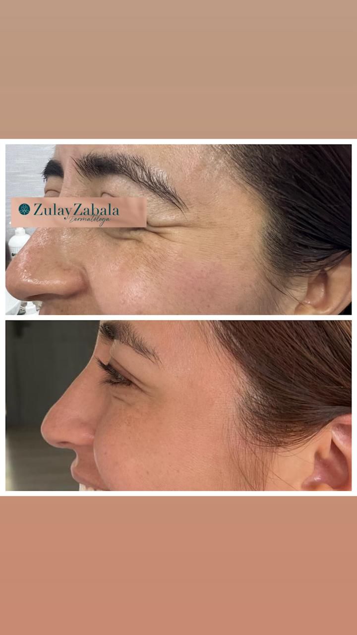 Zulay Angelica Zabala Suarez-41