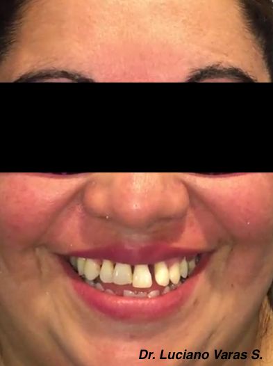 Luciano Varas Salinas-18