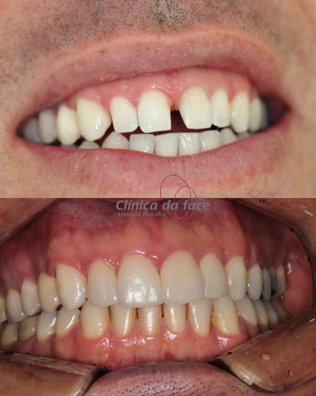 Odilia Liliam Almeida Botelho-0