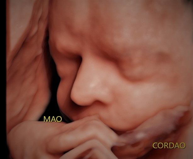 Charles Schwantz De Lima-11